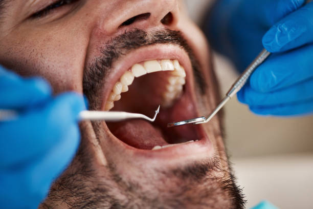 Best Broken or Cracked Tooth Emergency Dentist in Landisville, PA
